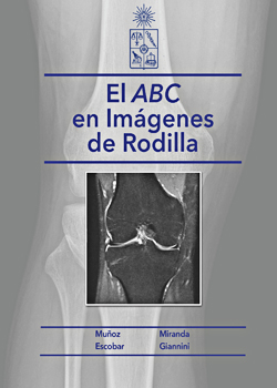 Cubierta para El ABC en imágenes de rodilla